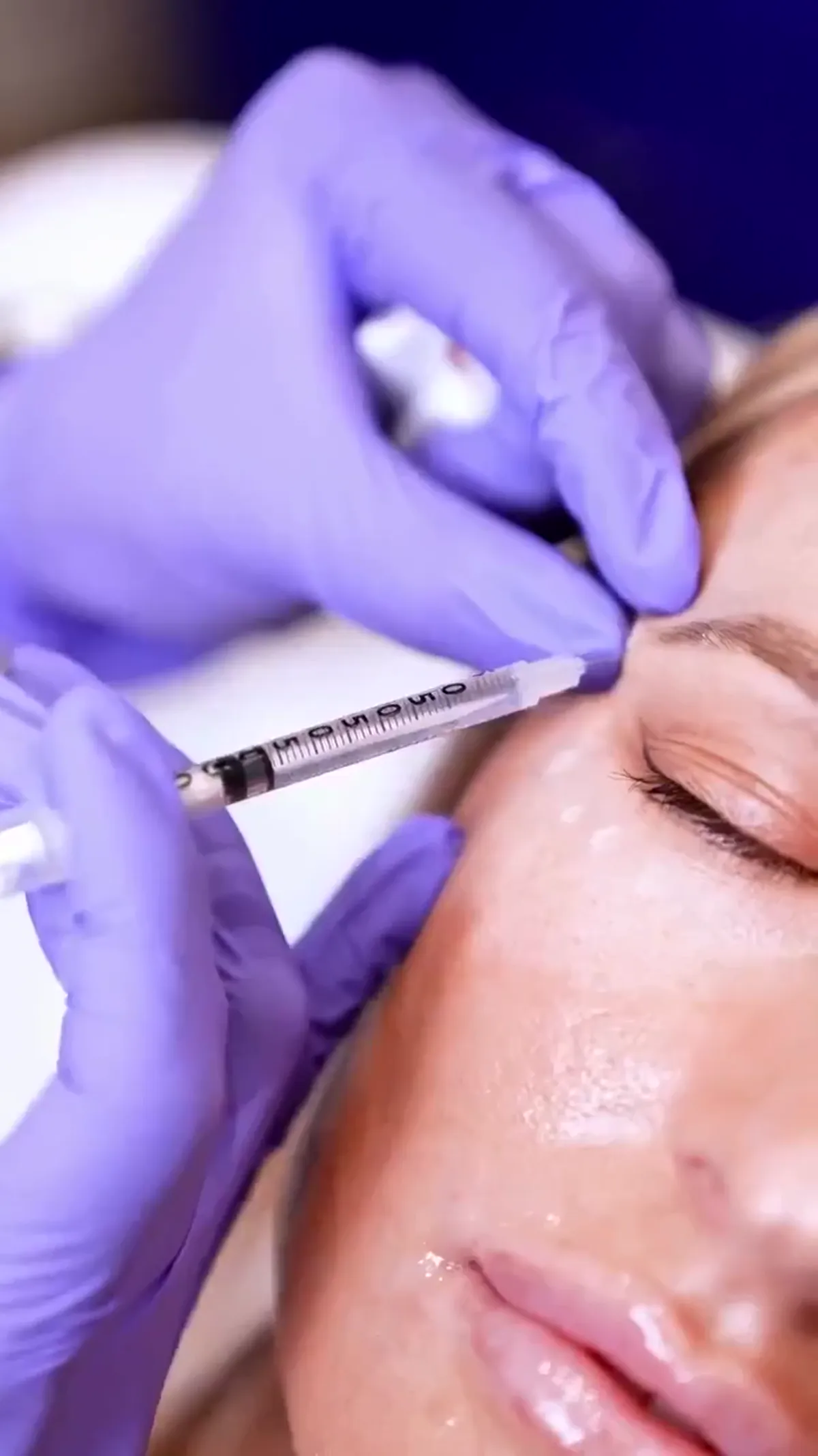 Dysport® treatment planning