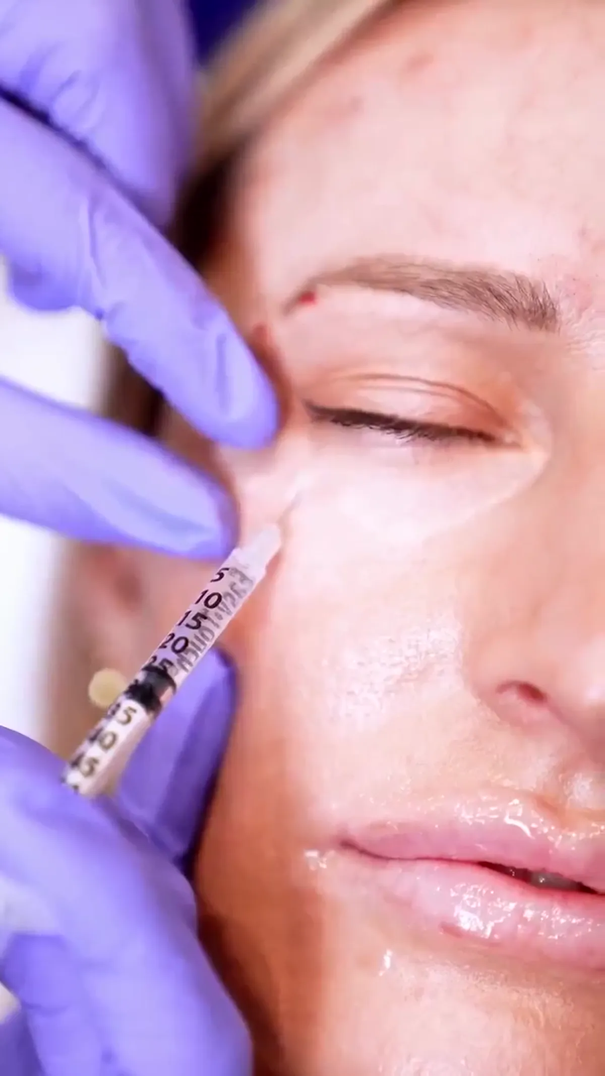 ZO Skin Centre Dallas treatment detail