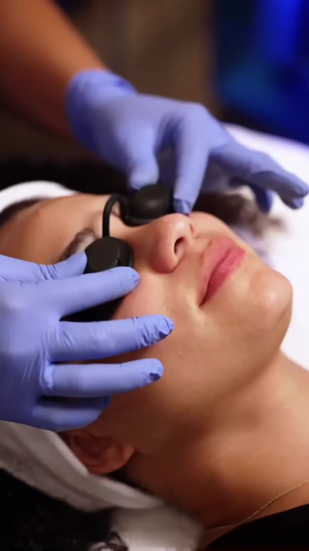 HydraFacial® treatment planning