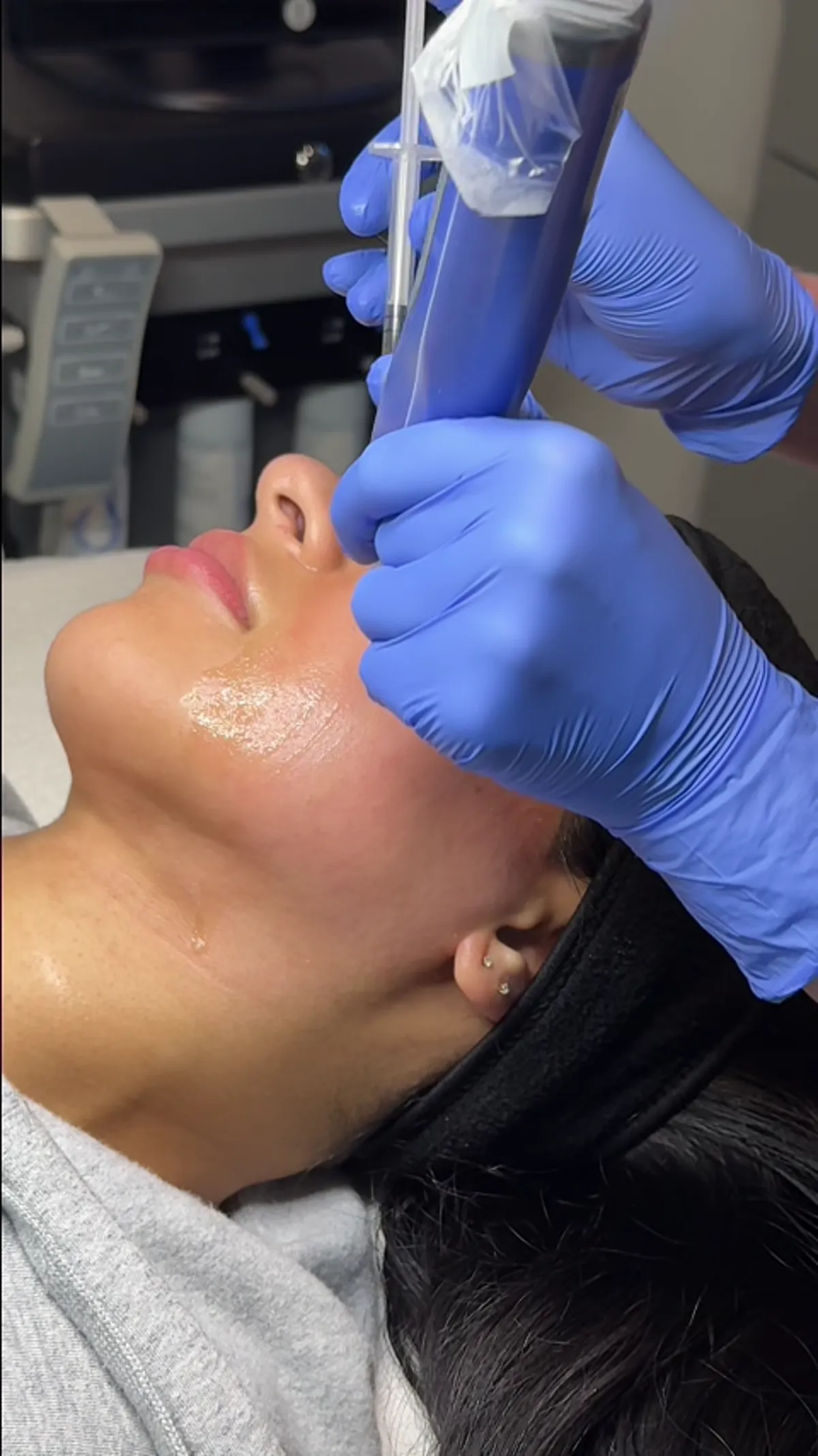 Microneedling treatment planning