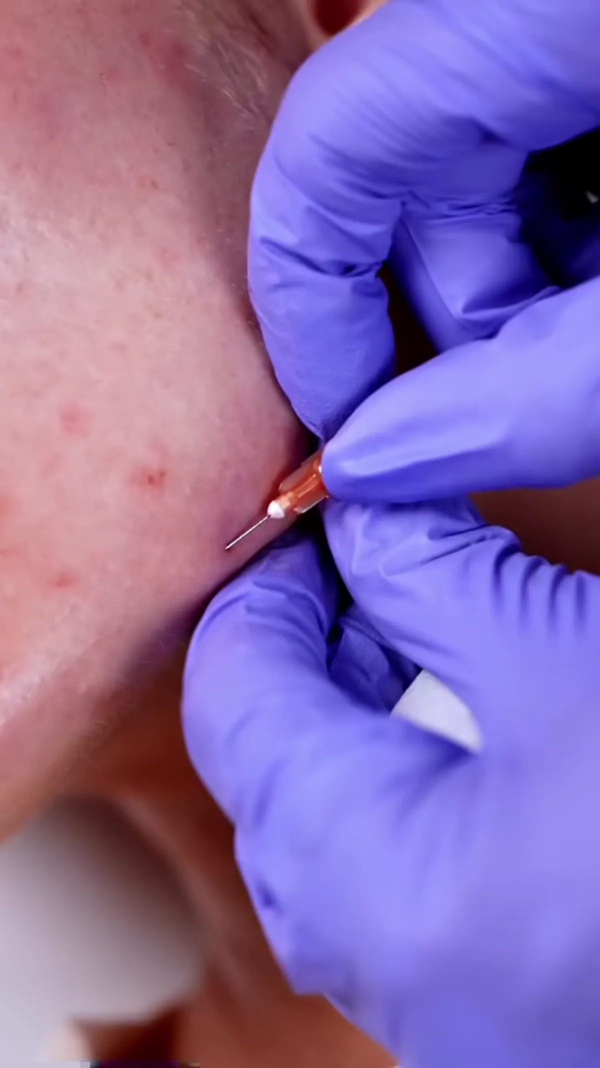 ZO Skin Centre Dallas treatment detail