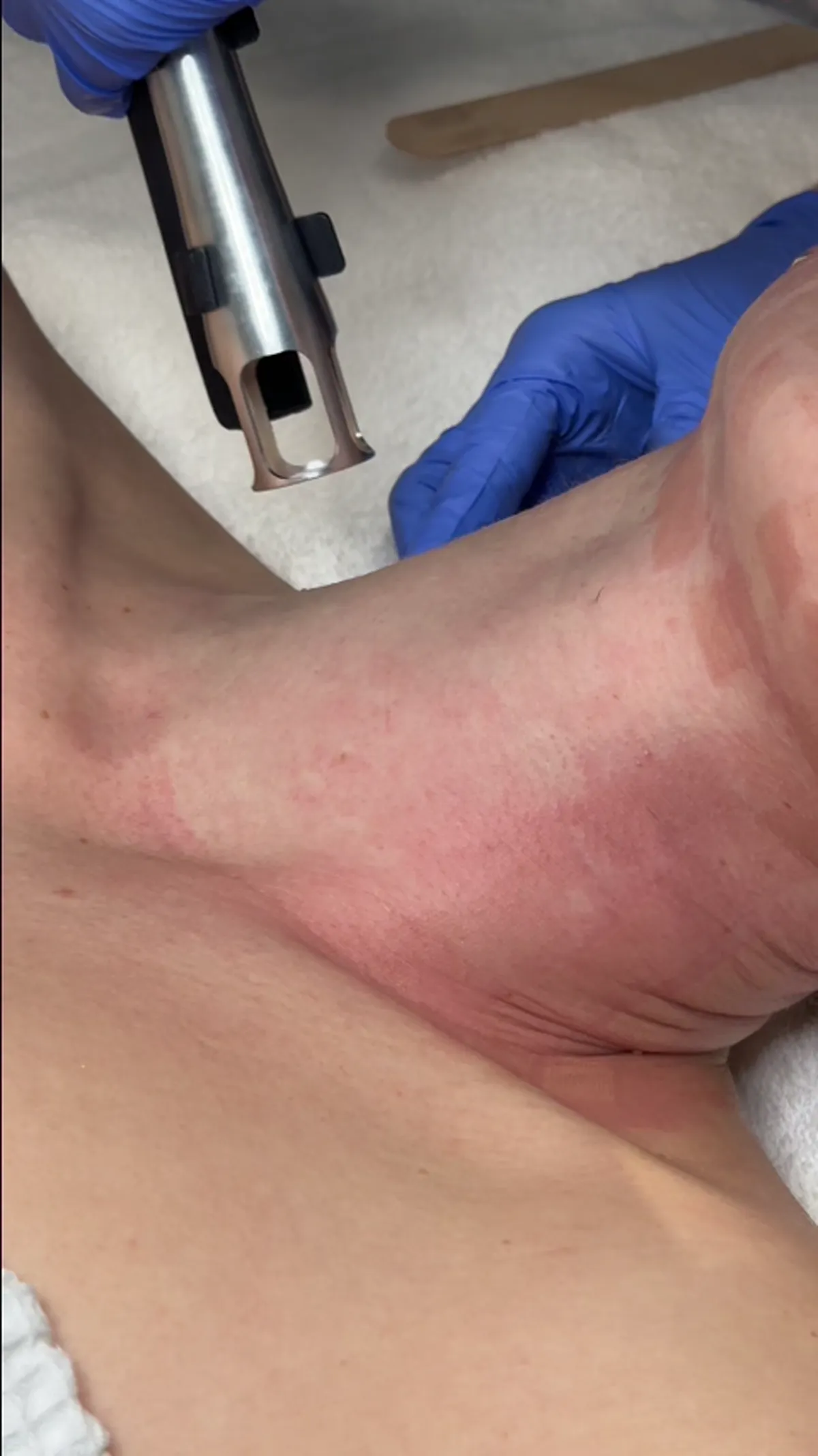 ZO Skin Centre Dallas treatment detail