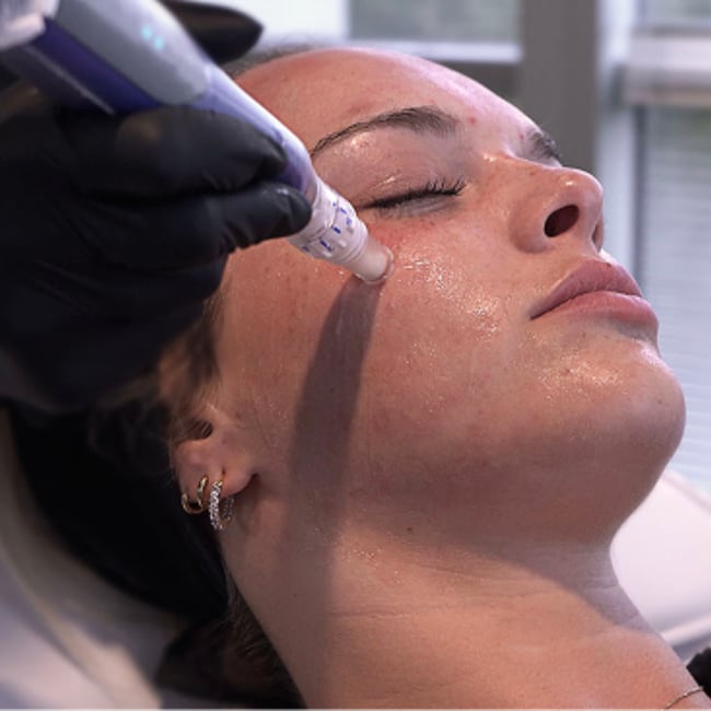 PDGF Ariessence blog image