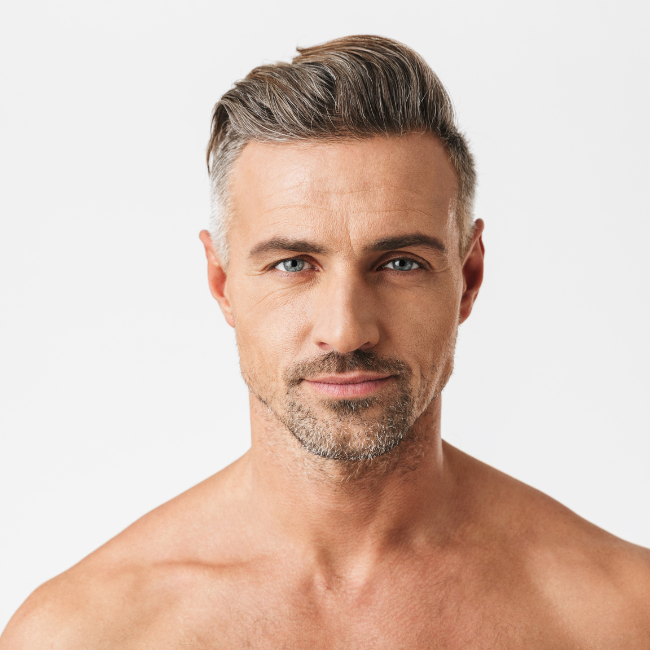 PRP hair restoration