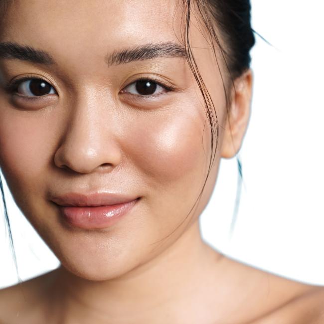 laser hair removal
