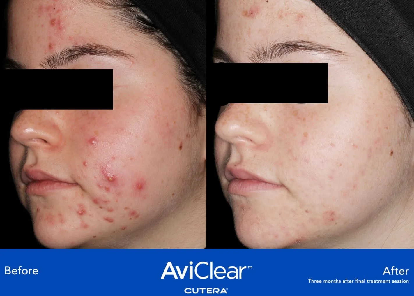 Clinical Results