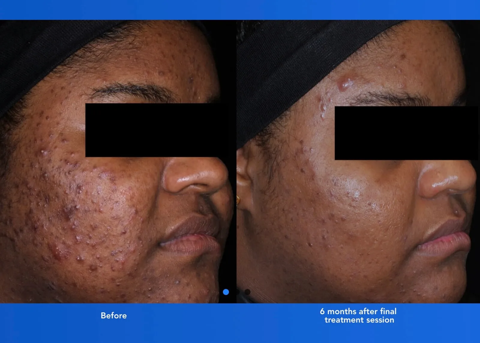 Clinical Results