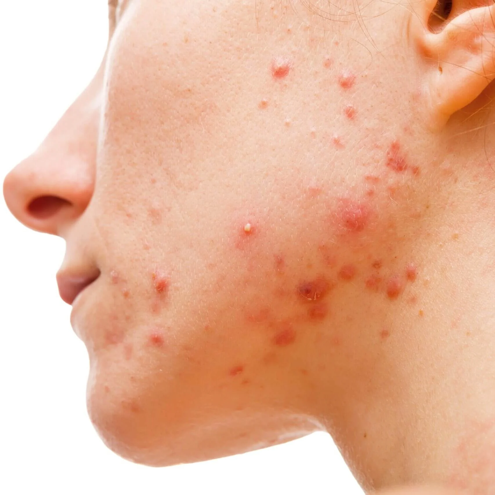 The importance of skin health during pregnancy