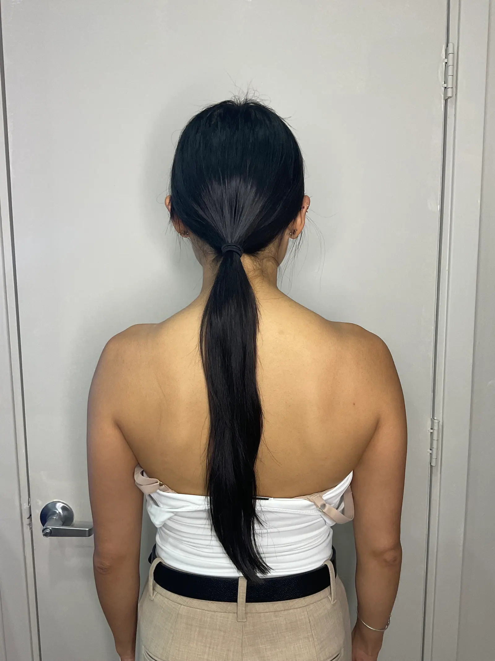 Trap BOTOX® by Mini before treatment